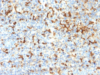 Recombinant TRP1 Antibody / Tyrosinase Related Protein 1 / TYRP1