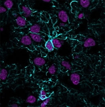 Recombinant GFAP Antibody / Rabbit Monoclonal