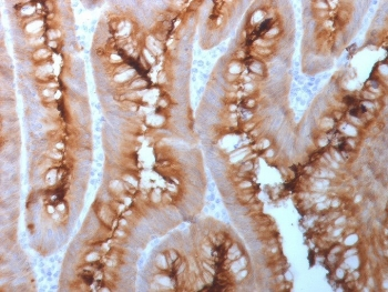 Recombinant CEA Antibody / CEACAM5