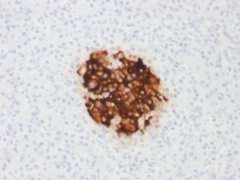 Recombinant Insulin Antibody