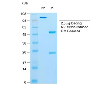 Recombinant Insulin Antibody