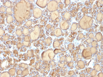Recombinant TG Antibody / Thyroglobulin