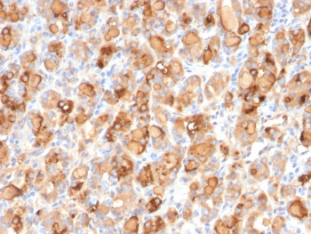 Recombinant Thyroglobulin Antibody / TG