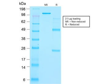 Recombinant Thyroglobulin Antibody / TG