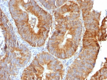 Recombinant TNFSF15 Antibody / TL1A / VEGI
