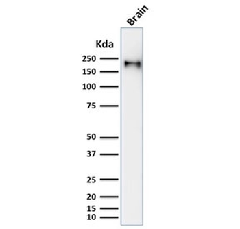 Recombinant Neurofilament Antibody / Heavy