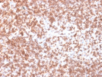 Recombinant CD45 Antibody / Rabbit Monoclonal