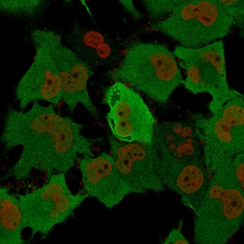 Recombinant PGP9.5 Antibody