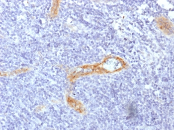 Recombinant von Willebrand Factor Antibody
