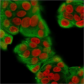 Recombinant Multi Cytokeratin Antibody / Rabbit Monoclonal