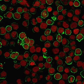 Recombinant CD20 Antibody
