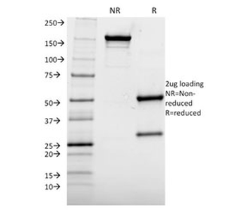 AKT1 Antibody
