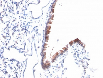 Mesothelin Antibody / MSLN
