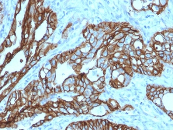 TROP2 Antibody / TACSTD2