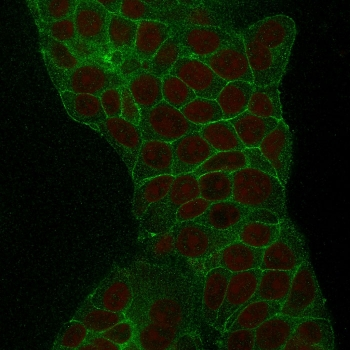 TROP2 Antibody / TACSTD2
