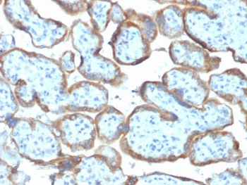 TIMP2 Antibody