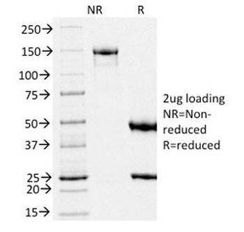 Melanoma gp100 Antibody / PMEL17