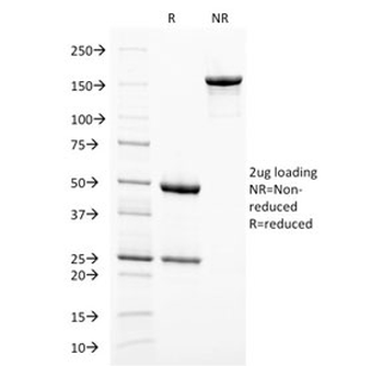 Melanoma gp100 Antibody / PMEL17