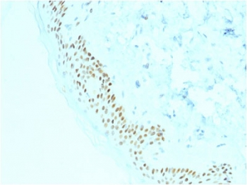 p63 Antibody