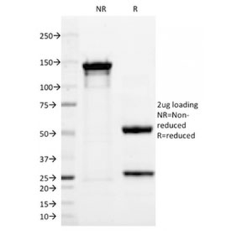 p63 Antibody