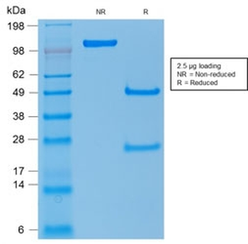 p53 Antibody / TP53