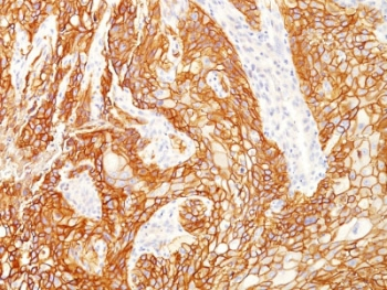 Recombinant EGFRvIII Antibody / EGF Receptor Variant III