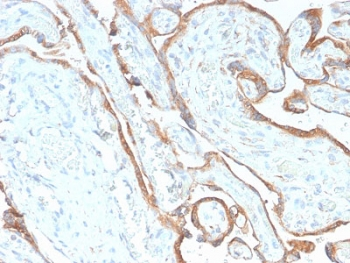 Recombinant EGF Receptor Antibody