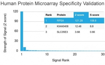 RPSA Antibody / 40S Ribosomal protein SA / Laminin Receptor 1