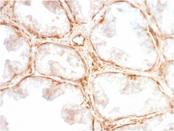 Recombinant Galectin 1 Antibody