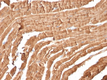 Myoglobin Antibody