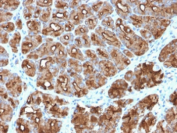 Recombinant Mucin-1 Antibody / Rabbit Monoclonal