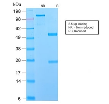Recombinant NGFR Antibody / p75NTR