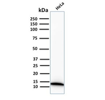 Recombinant S100A4 Antibody / FSP1