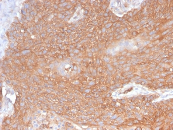 Recombinant Spectrin beta III Antibody / SPTBN2
