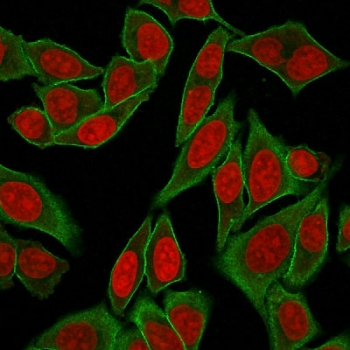Recombinant Spectrin beta III Antibody / SPTBN2