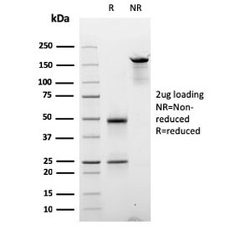 Cyclin D2 Antibody