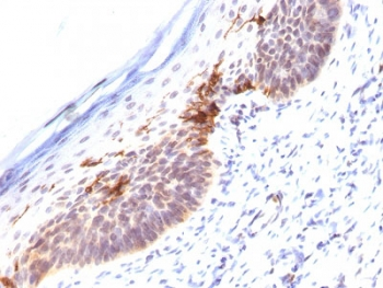 CD1a Antibody