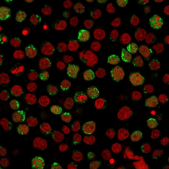 CD40 Ligand Antibody / TRAP / CD154