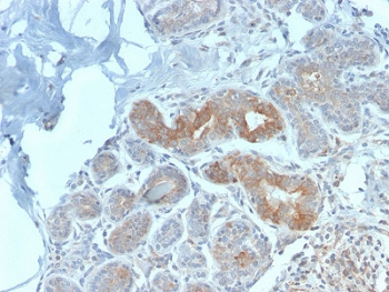 Recombinant MVP Antibody / Major Vault Protein