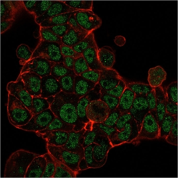 MSH6 Antibody