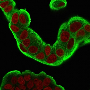 HSP27 Antibody