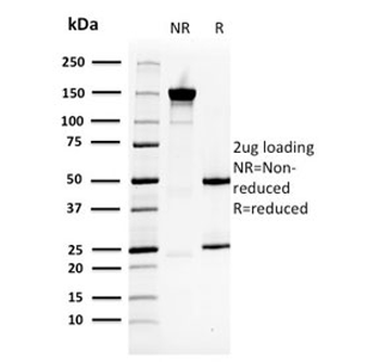 HSP27 Antibody