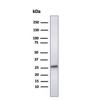 HSP27 Antibody