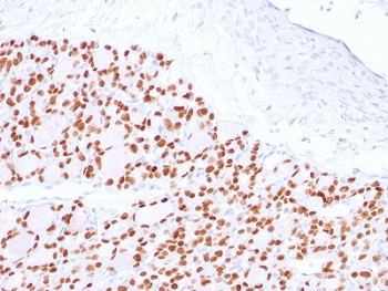 Recombinant PAX8 Antibody