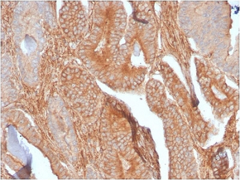Recombinant CD81 Antibody