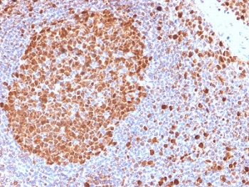 Recombinant MCM7 Antibody