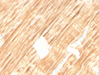 Sarcomeric Alpha Actinin Antibody / ACTN2