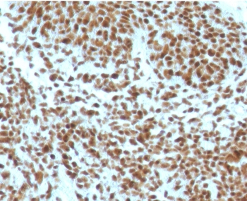 NPM Antibody / Nucleophosmin