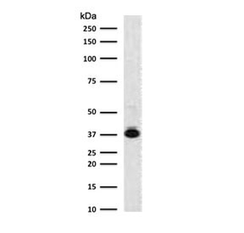 NPM Antibody / Nucleophosmin