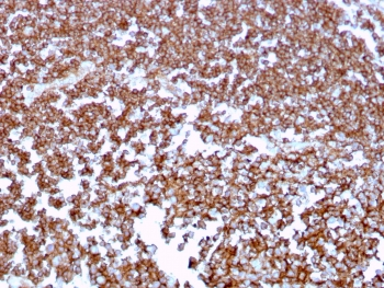 CD20 Antibody